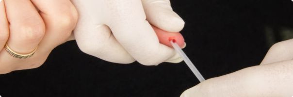 Doporučené postupy k odběrům krve – prevence preanalytické variability