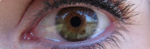 Jak ulevit očím během období alergií?