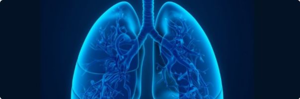 Rakovinu plic „umí“ nejlépe v centrech