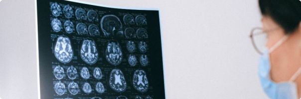 Nová magnetická rezonance urychlí diagnostiku onkologických pacientů v MOÚ