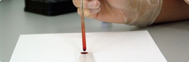 Zásobu vajíček v těle ženy umí odhalit test z krve – pojišťovny ho však zatím nechtějí proplácet