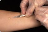 Proti žloutence chrání očkování, zájem o něj po covidu opět stoupá