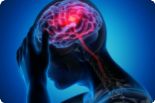 Lidi s migrénou spojí festival – jak na nemoc vyzrát, poradí odborníci i známé osobnosti