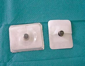 Obr. 2 – Intimní zátky pro irigujícího kolostomika