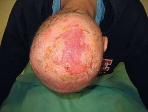 Obr. 13 – Převaz 9. 9.