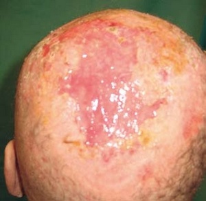 Obr. 14 – Převaz 12. 9. – den překladu do LDN