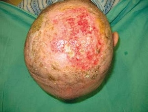 Obr. 12 – Převaz 7. 9.